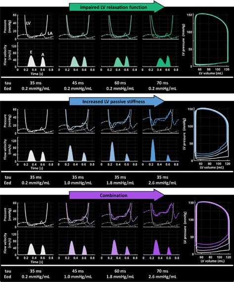 impaired left ventricular relaxation